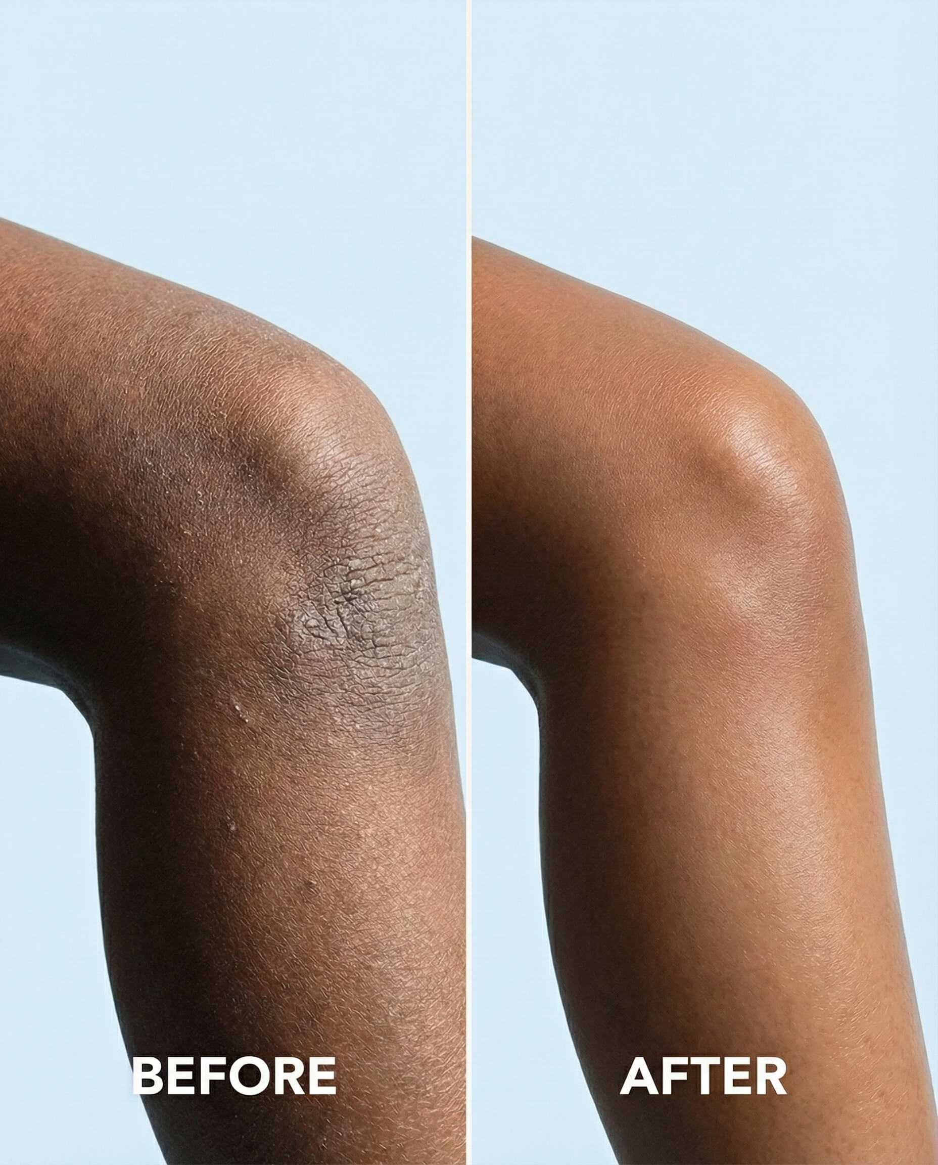 Regular Healing Cream